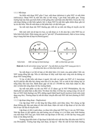 1.1.1. Mất đoạn 
108 
Sự thiếu một đoạn NST gồm 2 loại: mất đoạn (deletion) ở giữa NST và mất đỉnh 
(deficiency). Đoạn NST bị mất nếu nhỏ có thể mang 1 gen hoặc một phần gen. Trong 
trường hợp này hiệu quả kiểu hình có thể giống như xuất hiện alen đột biến ở locus đó. Các 
mất đoạn không có đột biến nghịch, bởi vì đoạn NST bị mất khó ngẫu nhiên được gắn trở 
lại do đột biến. Nhờ đó mất đoạn có thể phân biệt với đột biến gen. 
Sự mất một đoạn dài NST thường gây chết do sự mất cân bằng di truyền của bộ 
gen. 
Khi một sinh vật dị hợp tử (Aa), sự mất đoạn có A thì alen lặn a trên NST kia có 
biểu hiện kiểu hình. Hiện tượng này gọi là "giả trội" (Pseudodominant), thật ra locus tương 
ứng ở trạng thái bán dị hợp tử (Hemizygote). 
Kiểu hình: ABC (dị hợp tử bình thường) aBC (a biểu hiện giả trội) 
Hình 6.8. Sơ đồ mô tả hiện tương "giả trội" - Sự mất đỉnh của đoạn NST mang gen trội A 
cho phép alen lặn a có biểu hiện kiểu hình. 
Sự mất đoạn ở cá thể dị hợp có thể phát hiện ở kì trước của giảm phân I khi các 
NST tương đồng bắt cặp. Nếu có mất đoạn sẽ thấy xuất hiện một vòng tròn do không có 
đoạn NST tương đồng. 
Ví dụ về đột biến mất đoạn ở người: khi mất vai ngắn của NST số 5, karyotype 
46,XY,del(5p) dẫn đến hội chứng mèo kêu (Cri du chat). Trẻ sơ sinh bị hội chứng này có 
tiếng khác như mèo kêu. Bệnh được gặp với tần số 1/50.000 trẻ, biểu hiện chậm trí, đầu 
nhỏ và hiếm khi sống được tới lúc trưởng thành. 
Sự mất một phần vai dài của NST số 22 (được gọi là NST Philadelphia, lấy tên 
thành phố nơi phát hiện ra đầu tiên). Nó được tìm thấy ở tế bào tủy xương (cùng với các tế 
bào có NST bình thường) của 90% những người bệnh bạch huyết myelocyt kinh niên (một 
dạng ung thư). Thường đoạn bị mất đó được chuyển đến một NST dài hơn (thường là NST 
số 9). 
1.1.2. Lặp đoạn (tăng đoạn - Duplication) 
Các lặp đoạn NST có thể tăng lên bằng nhiều cách khác nhau. Nói chung sự lặp 
đoạn không gây hậu quả nặng nề như mất đoạn, thậm chí một số lặp đoạn có lợi cho tiến 
hóa là tạo vật liệu di truyền mới. 
Lặp đoạn có thể ở cạnh nhau, xa nhau trên cũng một NST hay ở vào các NST khác. 
Nhờ lặp đoạn có thể nghiên cứu ảnh hưởng của số lượng và vị trí khác mức bình thường 
của một đoạn NST hay gen. Kiểu hình của lặp đoạn có khi trội, có khi lặn hay trung gian 
hoặc có tác động tích lũy. 
Trường hợp điển hình về lặp đoạn là đột biến trội mắt thỏi Bar (B) nằm trên NST X 
của Drosophila. Trường hợp tăng một đoạn, dị hợp tử +/Bar thì mắt bé hơn bình thường 
 