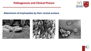 Pathogenesis and Clinical Picture
Attachment of trophozoites by their ventral suckers
 