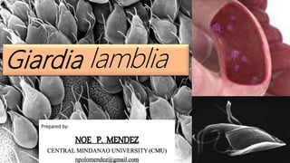 lamblia
Prepared by:
NOE P. MENDEZ
CENTRAL MINDANAO UNIVERSITY(CMU)
npolomendez@gmail.com
 