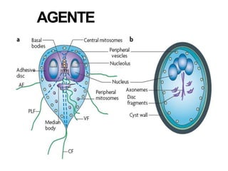 Comprehensive Overview of Giardiasis: Etiology, Clinical Features, and ...