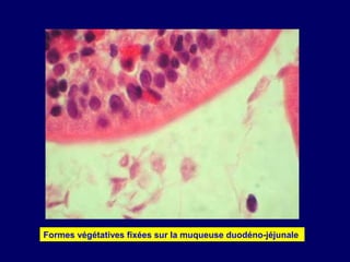 Formes végétatives fixées sur la muqueuse duodéno-jéjunale
 