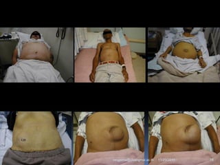 11/29/2010 19rangsima@chiangmai.ac.th
 