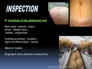 B. Condition of the abdominal wall
Skin-color , texture , scars ,
striae , dilated veins ,
rashes , angiomata.
Umbilicus-contour , location ,
signs of inflammation , hernia
Mass or nodule
Engorged veins-direction of blood flow
11/29/2010 20rangsima@chiangmai.ac.th
 