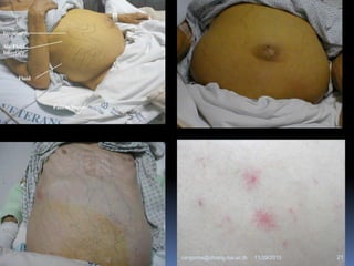 11/29/2010 21rangsima@chiangmai.ac.th
 