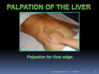 Palpation for liver edge.
11/29/2010 33rangsima@chiangmai.ac.th
 