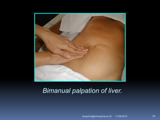 Bimanual palpation of liver.
11/29/2010 34rangsima@chiangmai.ac.th
 