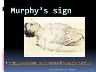 Murphy’s sign
 http://www.youtube.com/watch?v=9L7N89sOSuc
11/29/2010 39rangsima@chiangmai.ac.th
 