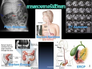 11/29/2010 44rangsima@chiangmai.ac.th
 
