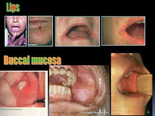 11/29/2010 6rangsima@chiangmai.ac.th
 