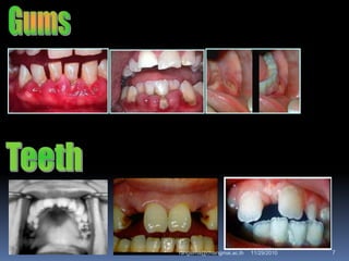 11/29/2010 7rangsima@chiangmai.ac.th
 