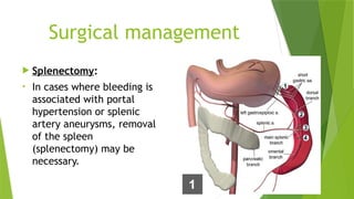 GI BLEED.pptx- introduction, definition, types, causes, signs and ...