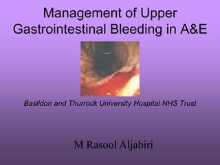 Management of Upper
Gastrointestinal Bleeding in A&E
Basildon and Thurrock University Hospital NHS Trust
M Rasool Aljabiri
 