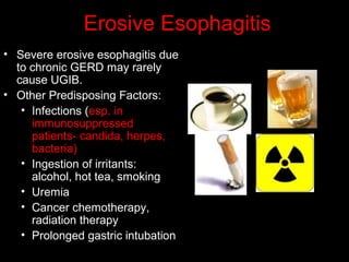 Erosive Esophagitis
• Severe erosive esophagitis due
to chronic GERD may rarely
cause UGIB.
• Other Predisposing Factors:
• Infections (esp. in
immunosuppressed
patients- candida, herpes,
bacteria)
• Ingestion of irritants:
alcohol, hot tea, smoking
• Uremia
• Cancer chemotherapy,
radiation therapy
• Prolonged gastric intubation
 