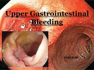 Upper Gastrointestinal
Bleeding
Kritika Singh
 
