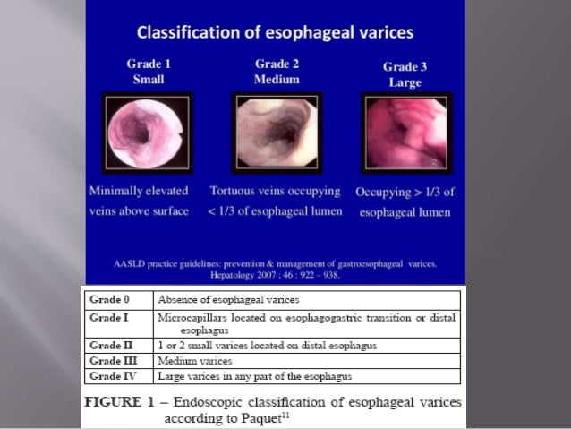 Gi Bleeding Presentation Gi Bleeding Presentation