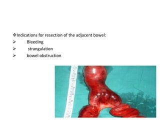 ❖Indications for resection of the adjacent bowel:
➢ Bleeding
➢ strangulation
➢ bowel obstruction
 
