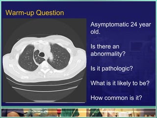 Warm-up Question
                   Asymptomatic 24 year
                   old.

                   Is there an
                   abnormality?

                   Is it pathologic?

                   What is it likely to be?

                   How common is it?
 
