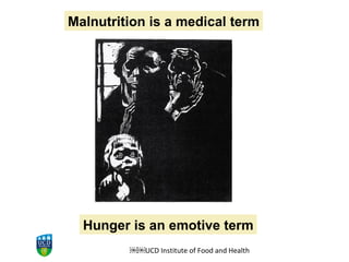 ￼￼ UCD Institute of Food and Health Hunger is an emotive term Malnutrition is a medical term 