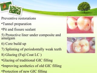 Preventive restorations
•Tunnel preparation
•Pit and fissure sealant
5) Protective liner under composite and
amalgam
6) Core build up
7) Splinting of periodontally weak teeth
8) Glazing (Fuji Coat LC )
•Glazing of traditional GIC filling
•Improving aesthetics of old GIC filling
•Protection of new GIC filling
 