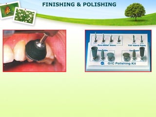 FINISHING & POLISHING
 