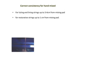 Correct consistency for hand mixed
• For luting and lining strings up to 3-4cm from mixing pad
• for restorative strings up to 1 cm from mixing pad.
 