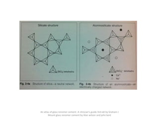 An atlas of glass ionomer cement- A clinician's guide 3rd edi by Graham J
Mount glass ionomer cement by Alan wilson and john kent
 