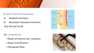 9. Other restorative techniques
a) Sandwich technique
b) Atraumatic restorative treatment
(Fuji VIII and Fuji IX)
10. In Endodontics
• Repair of external root resorption
• Repair of perforation
• Retrograde filling
 