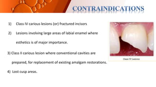 1) Class IV carious lesions (or) fractured incisors
2) Lesions involving large areas of labial enamel where
esthetics is of major importance.
3) Class II carious lesion where conventional cavities are
prepared, for replacement of existing amalgam restorations.
4) Lost cusp areas.
 