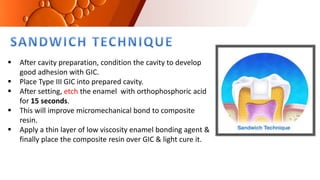  After cavity preparation, condition the cavity to develop
good adhesion with GIC.
 Place Type III GIC into prepared cavity.
 After setting, etch the enamel with orthophosphoric acid
for 15 seconds.
 This will improve micromechanical bond to composite
resin.
 Apply a thin layer of low viscosity enamel bonding agent &
finally place the composite resin over GIC & light cure it.
 
