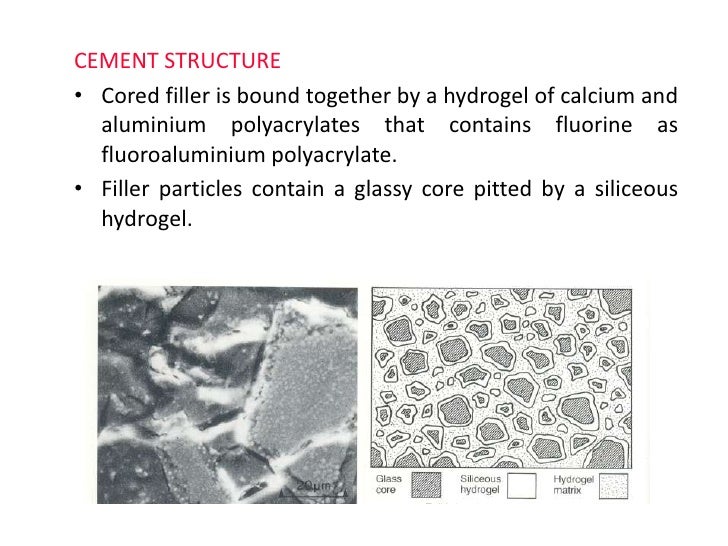Glass Ionomer Cement (GIC) Science of Dental materials