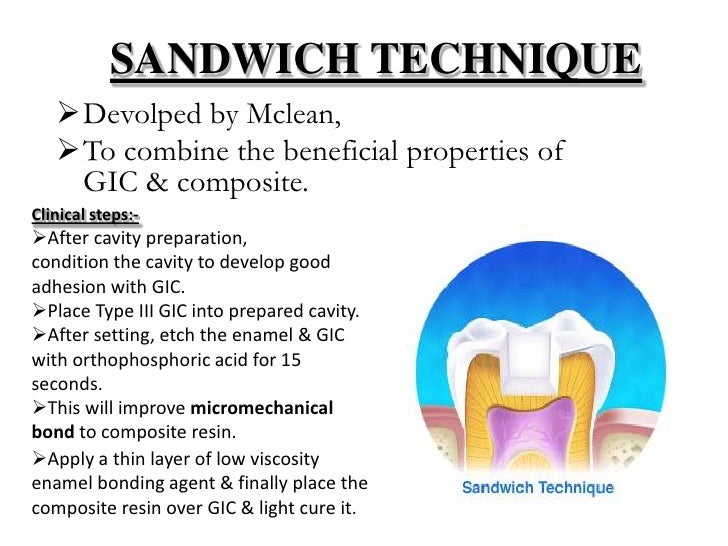 Glass Ionomer Cement (GIC) Science of Dental materials