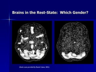 Brains in the Rest-State: Which Gender?




   (brain scans provided by Daniel Amen, M.D.)
 