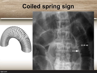 GI Classic Sign.ppt