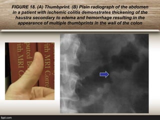 GI Classic Sign.ppt
