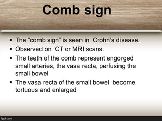 GI Classic Sign.ppt