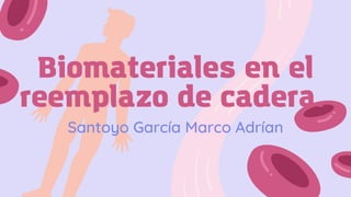 Biomateriales en el
reemplazo de cadera.
Santoyo García Marco Adrían
 