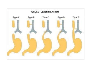 Gi Incurred Development Pattern GI development embryology & Concept of Peritoneum | PPTX