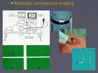 Gi diagnostic & therapeutic endoscopy | PPT