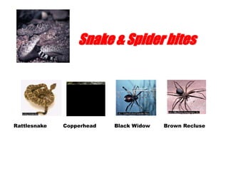 Snake & Spider bites
Rattlesnake Copperhead Black Widow Brown Recluse
 
