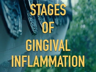 STAGES
OF
GINGIVAL
INFLAMMATION
 