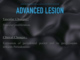 ADVANCED LESION
Vascular Changes :
Vascular proliferation.
Clinical Changes :
Formation of periodontal pocket and its progressions
towards Periodontitis.
GINGIVAL INFLAMMATION & CLINICAL FEATURES OF GINGIVITIS
 