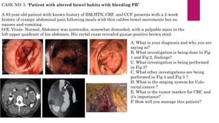 CASE NO: 5: ‘Patient with altered bowel habits with bleeding PR’
A 83-year-old patient with known history of DM,HTN, CRF, and CCF presents with a 2-week
history of crampy abdominal pain following meals with thin calibre bowel movements but no
nausea and vomiting.
O/E: Vitals- Normal, Abdomen was nontender, somewhat distended, with a palpable mass in the
left upper quadrant of his abdomen. His rectal exam revealed guaiac-positive brown stool.
A. What is your diagnosis and why you are
saying so?
B. What investigation is being done in Fig
1 and Fig 2, findings?
C. What investigation is being performed
in Fig 3?
C. What other investigations are being
performed in Fig 4 and Fig 5 ?
D. What is the staging system for Colo-
rectal cancer ?
E. What is the tumor marker for CRC and
it’s importance?
F. How will you manage this patient?
 