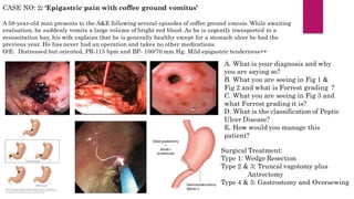 CASE NO: 2: ‘Epigastric pain with coffee ground vomitus’
A 58-year-old man presents to the A&E following several episodes of coffee ground emesis. While awaiting
evaluation, he suddenly vomits a large volume of bright red blood. As he is urgently transported to a
resuscitation bay, his wife explains that he is generally healthy except for a stomach ulcer he had the
previous year. He has never had an operation and takes no other medications.
O/E: Distressed but oriented, PR-115 bpm and BP- 100/70 mm Hg. Mild epigastric tenderness++
A. What is your diagnosis and why
you are saying so?
B. What you are seeing in Fig 1 &
Fig 2 and what is Forrest grading ?
C. What you are seeing in Fig 3 and
what Forrest grading it is?
D. What is the classification of Peptic
Ulcer Disease?
E. How would you manage this
patient?
Surgical Treatment:
Type 1: Wedge Resection
Type 2 & 3: Truncal vagotomy plus
Antrectomy
Type 4 & 5: Gastrostomy and Oversewing
 