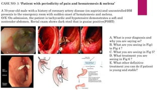 CASE NO: 3: ‘Patient with periodicity of pain and hematemesis & melena’
A 70-year-old male with a history of coronary artery disease (on aspirin) and uncontrolled DM
presents to the emergency room with sudden onset of hematemesis and melena.
O/E: On admission, the patient is tachycardic and hypotensive demonstrates a soft and
nontender abdomen. Rectal exam shows dark stool that is guaiac positive(FOBT)
A. What is your diagnosis and
why you are saying so?
B. What are you seeing in Fig1
to Fig 4 ?
C. What you are seeing in Fig 5?
D. What treatment you are
seeing in Fig 6 ?
E. What other definitive
treatment you can do if patient
is young and stable?
 