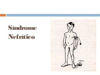 Síndrome
Nefrítico
 