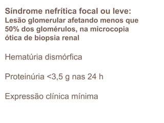 Síndrome nefrítica focal ou leve:
Lesão glomerular afetando menos que
50% dos glomérulos, na microcopia
ótica de biopsia renal
Hematúria dismórfica
Proteinúria <3,5 g nas 24 h
Expressão clínica mínima
 