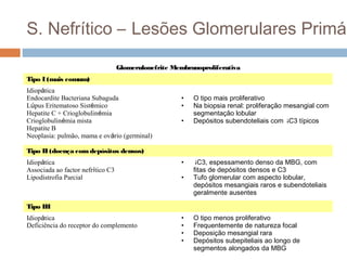 S. Nefrítico – Lesões Glomerulares Primár
Glomerulonefrite Membranoproliferativa
Tipo I (mais comum)
Idiopática
Endocardite Bacteriana Subaguda
Lúpus Eritematoso Sistémico
Hepatite C + Crioglobulinémia
Crioglobulinémia mista
Hepatite B
Neoplasia: pulmão, mama e ovário (germinal)
• O tipo mais proliferativo
• Na biopsia renal: proliferação mesangial com
segmentação lobular
• Depósitos subendoteliais com ↓C3 típicos
Tipo II (doença comdepósitos densos)
Idiopática
Associada ao factor nefrítico C3
Lipodistrofia Parcial
• ↓C3, espessamento denso da MBG, com
fitas de depósitos densos e C3
• Tufo glomerular com aspecto lobular,
depósitos mesangiais raros e subendoteliais
geralmente ausentes
Tipo III
Idiopática
Deficiência do receptor do complemento
• O tipo menos proliferativo
• Frequentemente de natureza focal
• Deposição mesangial rara
• Depósitos subepiteliais ao longo de
segmentos alongados da MBG
 