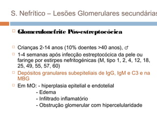 S. Nefrítico – Lesões Glomerulares secundárias
 Glomerulonefrite Pós-estreptocócica
 Crianças 2-14 anos (10% doentes >40 anos), ♂
 1-4 semanas após infecção estreptocócica da pele ou
faringe por estirpes nefritogénicas (M, tipo 1, 2, 4, 12, 18,
25, 49, 55, 57, 60)
 Depósitos granulares subepiteliais de IgG, IgM e C3 e na
MBG
 Em MO: - hiperplasia epitelial e endotelial
- Edema
- Infiltrado inflamatório
- Obstrução glomerular com hipercelularidade
 