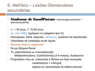 S. Nefrítico – Lesões Glomerulares
secundárias
 Síndrome de GoodPasture (Hemorragia pulmonar +
Glomerulonefrite)
 ♂ > 30 anos, ♀ 70-80 anos
 Ac. Anti- MBG (epitopos no colagénio tipo IV)
 Hemoptises, febre, dispneia, hematúria, ausência de hipertensão
 Velocidade de instalação muito rápida
 Necrose focal ou segmentar
 Dx por Biópsia Renal
 Tx: plasmaferése ou imunoabsorção
Metilprednisolona, Ciclofosfamida (3-4 meses), Azatioprina
 Prognóstico mau se: crescentes e fibrose em fase avançada
creatininémia > 5-6mg/dl
oligúria ou necessidade de diálise precoce
 