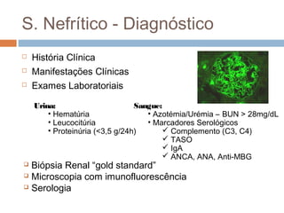 S. Nefrítico - Diagnóstico
 História Clínica
 Manifestações Clínicas
 Exames Laboratoriais
Urina:
• Hematúria
• Leucocitúria
• Proteinúria (<3,5 g/24h)
Sangue:
• Azotémia/Urémia – BUN > 28mg/dL
• Marcadores Serológicos
 Complemento (C3, C4)
 TASO
 IgA
 ANCA, ANA, Anti-MBG
 Biópsia Renal “gold standard”
 Microscopia com imunofluorescência
 Serologia
 